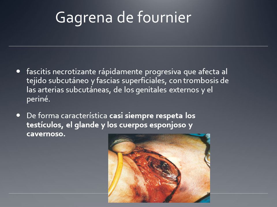La Vida Era Eso Carmen Amoraga Pdf